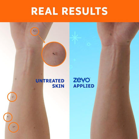 Zevo On-Body Lotion Insect Repellent Lotion For Mosquitoes/Ticks 5.8 oz, Pack of 12